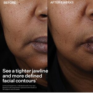 Results Guaranteed!Strivectin Peptight™ Face Lift Serum 30ml